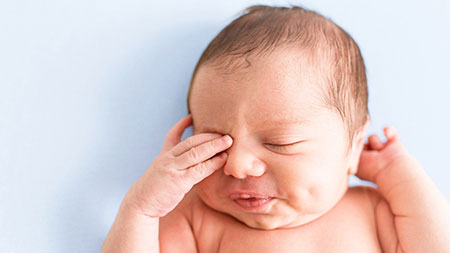 علل پف زیر چشم نوزادان چیست؟